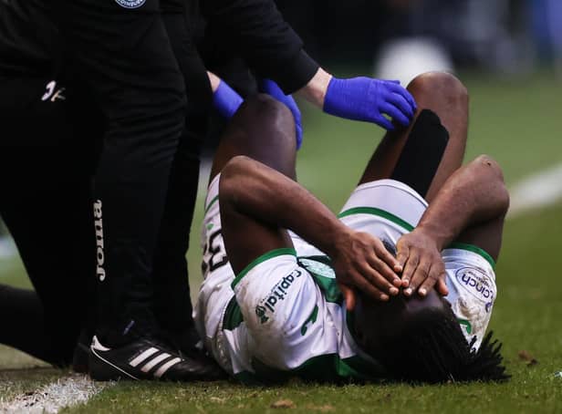 Rocky Bushiri was injured in Hibs' 3-0 defeat to Hearts in the Scottish Cup fourth round last Sunday. (Photo by Craig Williamson / SNS Group)