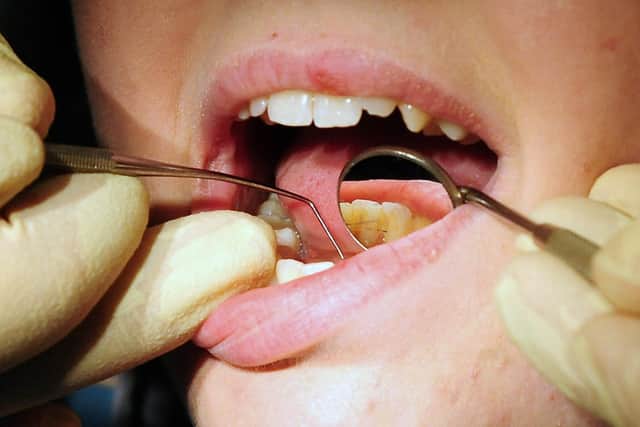 Thousands of Scots are paying for private dental care (Photo by Rui Vieira/PA)