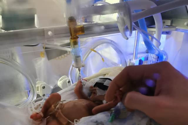Miracle baby Sofia was born at just 22 weeks weighing 1.1lbs picture: NHS Lanarkshire