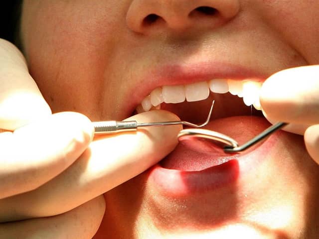 The EU is set to prohibit the use of amalgam from January 2025 as part of a health drive to reduce public exposure to mercury