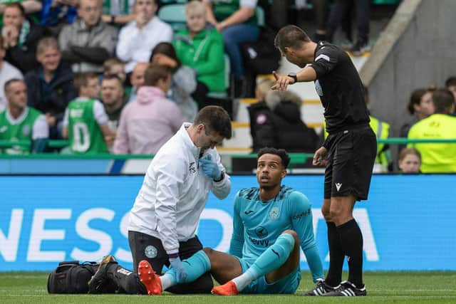 Hibs' Jojo Wollacott is forced off with an injury during his side's Europa Conference League qualifier win over Inter Club d'Escaldes at Easter Road,. Photo by Mark Scates / SNS Group