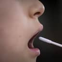Tackling long Covid stigma needs “urgent” action from the Scottish Government, a committee report said as ministers were urged to establish a single point of contact for sufferers in every health board.