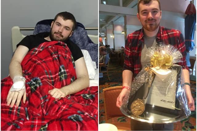 Connor during and after treatment.