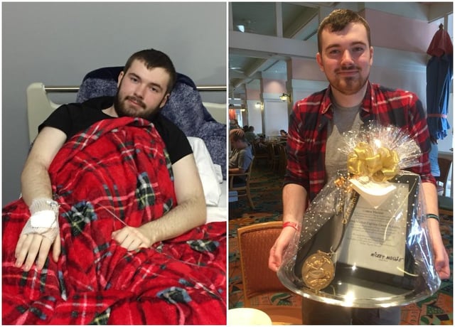 Connor during and after treatment.
