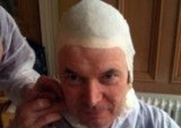 Ian Rankin having the plaster applied to his face. Picture: Pressteam