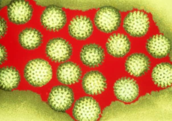 Rotaviruses is the most common cause of severe diarrhoea in children. Picture: submitted