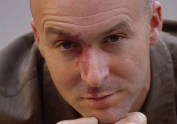 Author Christopher Brookmyre has a port-wine birthmark. Picture: Callum Bennetts