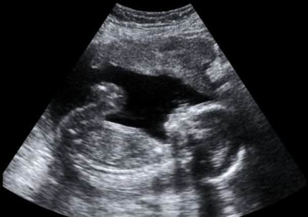 An ultrasound scan of an unborn baby. Picture: Contributed