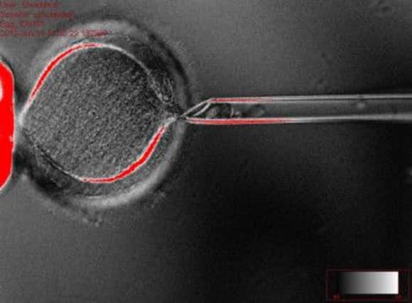 Scientists acquired stem cells cloned from skin. Picture: PA
