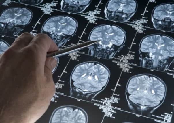 Alzheimer's drug may be 'too good to be true'. Picture: Contributed