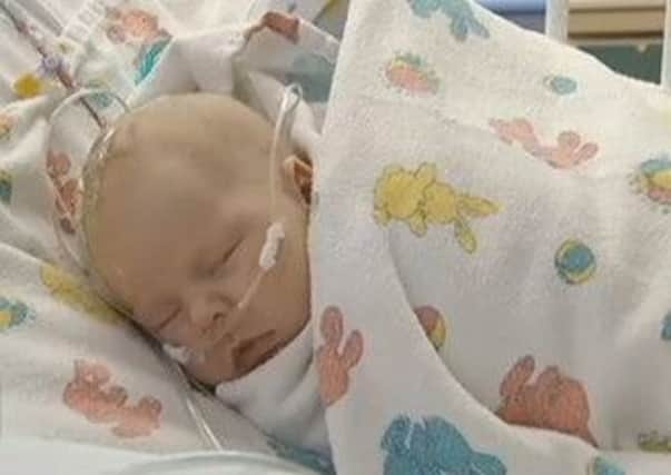 Baby Ashlyn Julian is recovering after the unique operation. Picture: CBSAtlanta (Contributed)