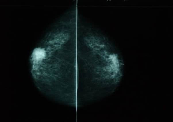 Women who are at risk will be offered drugs to reduce the likleyhood of breast cancer. Picture: Phil Wilkinson