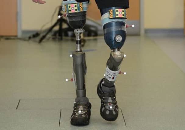 The Scottish Government has launched a new specialist prosthetics service for military amputees. Picture: Neil Hanna