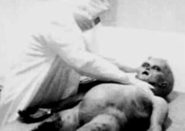A screengrab from an autopsy video examining the supposed body of an alien found at Roswell in 1947. Picture: Contributed