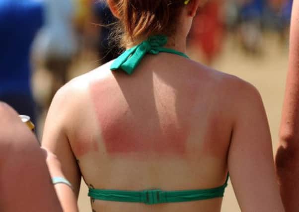 Most men and women in Scotland diagnosed with skin cancer will now survive the disease, a new report has revealed. Picture: PA