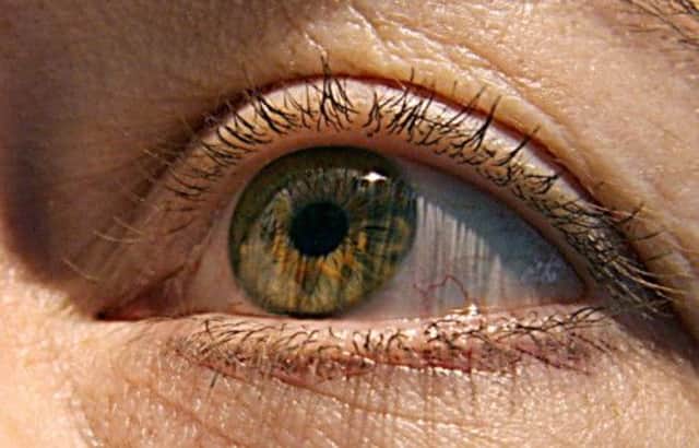 Researchers found that those paralysed could communicate through their eyes. Picture: AFP