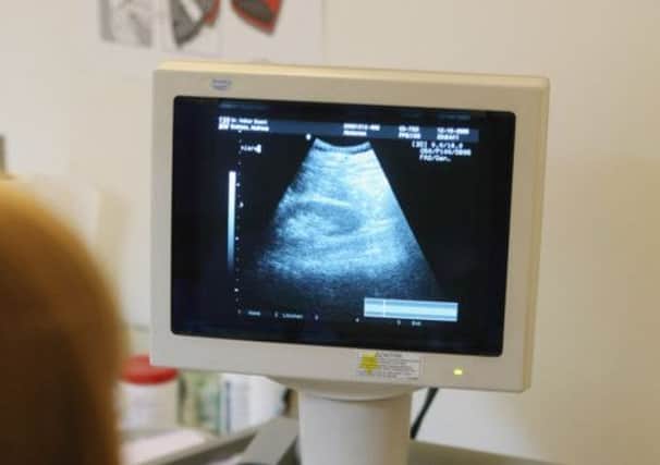 An ultrasound scan in progress. A panel yesterday said women should aim to have children before the age of 35. Picture: Getty