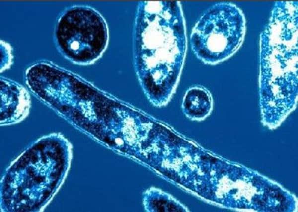 Two people are being treated in intensive care with Legionella in Scotland. Picture: Comp