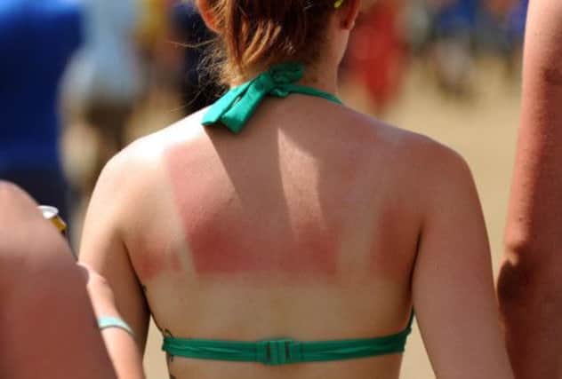 About 1,200 Scots a year are diagnosed with malignant melanoma. Picture: PA