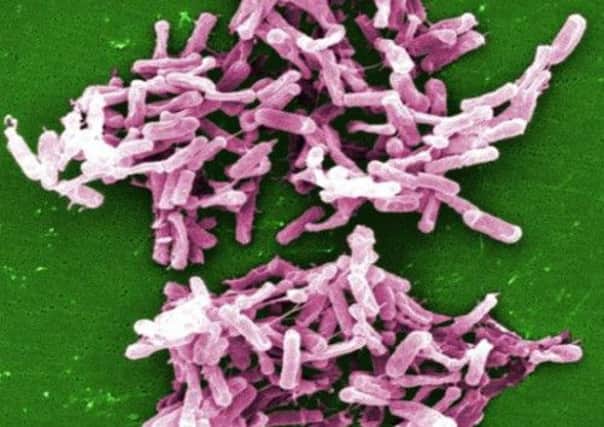 A micrograph of C. difficile bacteria. Picture: Contributed
