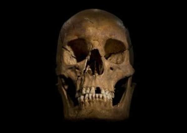 The skull of Richard III. Picture: PA/ University of Leicester