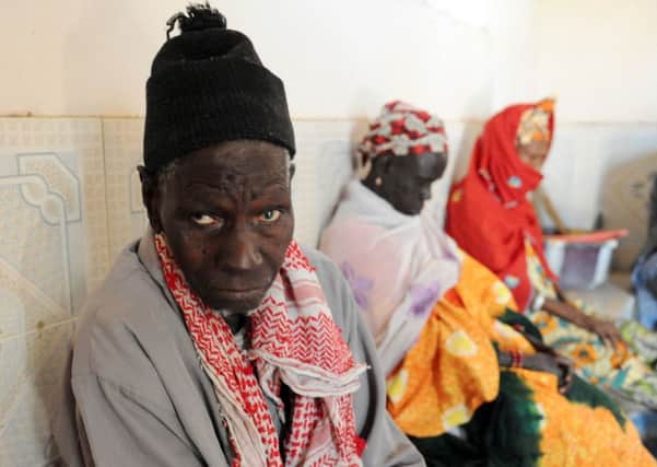 A Senegalese leprosy sufferer waits for treatment. Picture: Getty