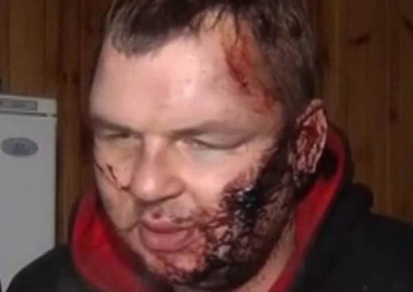 A bloodied and bruised Dmytro Bulatov yesterday. Picture: AP