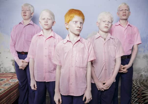 A group of blind albino boys in their boarding room at the Vivekananda mission school for the blind in West Bengal. Picture: Brent Stirton