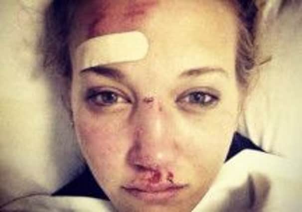 A cut and bruised Rowan Cheshire after an accident during training on Sunday. Picture: Twitter