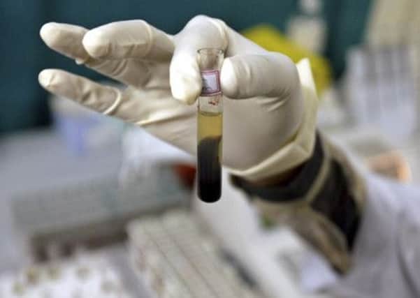 A new blood test predicting whether someone will develop Alzheimer's has been devised by scientists. Picture: REUTERS