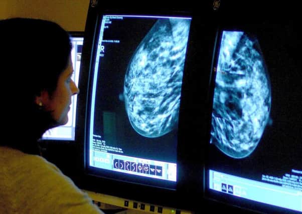 Early forms of breast cancer may be recieving more radical surgery than required. Picture: PA Wire