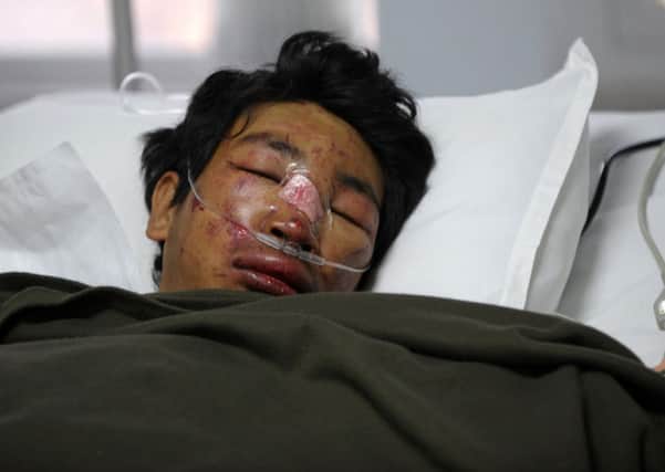 Nepalese mountaineer Dawa Tashi Sherpa lies in intensive care. Picture: Getty