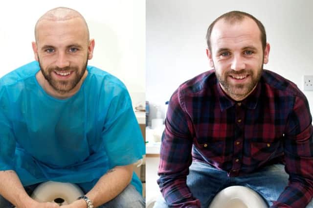 Before and after: James McFadden. Pictures: Hemedia