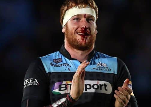 A battered and bloodied, but proud, Rob Harley. Picture: Ian MacNicol/Getty
