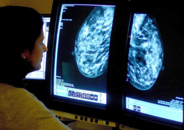 More than 4,500 cases of breast cancer are diagnosed in Scotland every year. Picture: PA