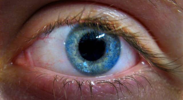 In 2006 there were 787 children registered blind or partially sighted in Scotland, rising to 869 in 2012. Picture: PA