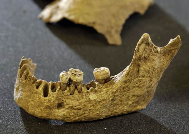 Part of the skull of the skeleton which could be that of a Viking King of Dublin. Picture: Donald MacLeod