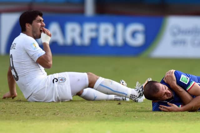 Uruguay's forward Luis Suarez grips his teeth as Italy's defender Giorgio Chiellini clasps his shoulder after the incident. Picture: Getty