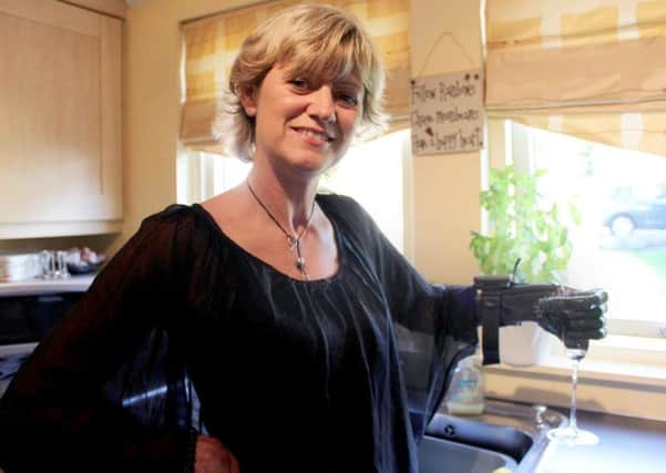 Corinne Hutton with her bionic hand. Picture: Hemedia