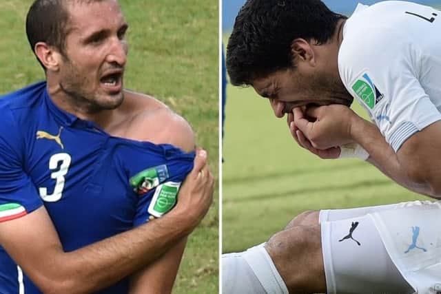 Giorgio Chiellini, left, shows an apparent bitemark and Luis Suarez holds his teeth after the incident. Picture: Getty