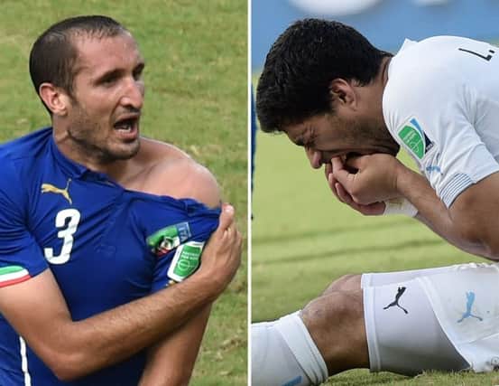 Giorgio Chiellini, left, shows an apparent bitemark and Luis Suarez holds his teeth after the incident. Picture: Getty