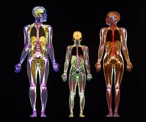 Whole body scans produced by MRI are possible as a result of development by scientists working at Edinburgh Uni