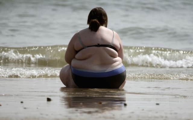 Type 2 diabetes is lifestyle-related and strongly associated with obesity. Picture: Getty Images