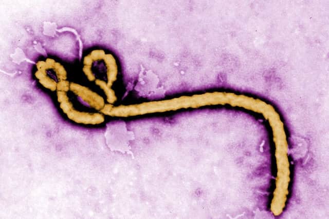 Photo of the ebola virus. Picture: PA