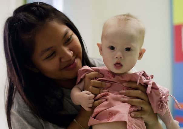 Thai surrogate mother Pattaramon Chanbua holds her baby Gammy, born with Down Syndrome, at the Samitivej hospital. Picture: Getty