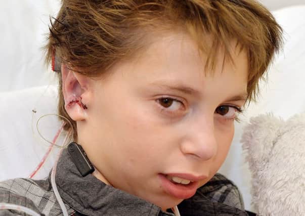 Kieran Sorkin, aged 8, from Hertfordshire, who has received a new set of ears after experts at Great Ormond Street Hospital (GOSH). Picture: PA