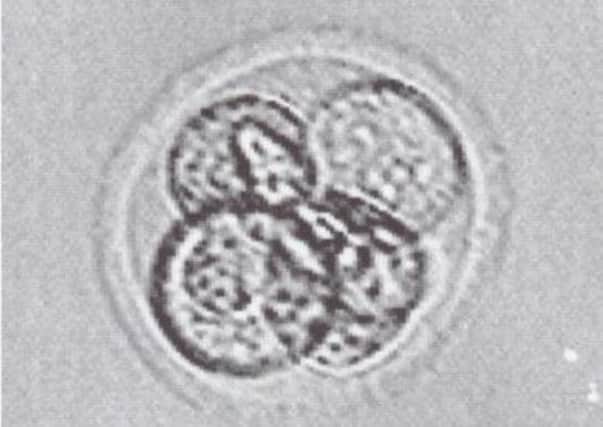 An early stage human embryo. Picture: PA