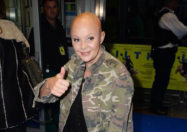 TV presenter Gail Porter refuses to hide the result of her alopecia. Picture: Getty