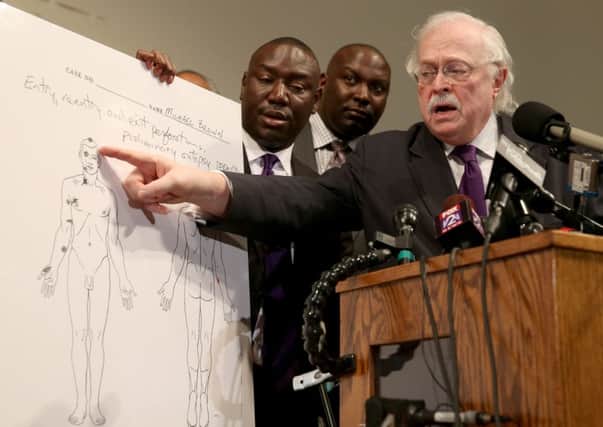 Dr Michael Baden points to an autopsy diagram showing where the gun shots hit Michael Brown during a press conference. Picture: Getty