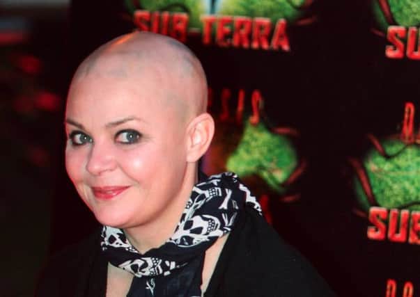 Gail Porter is perhaps the best-known sufferer of alopecia. Picture: Getty